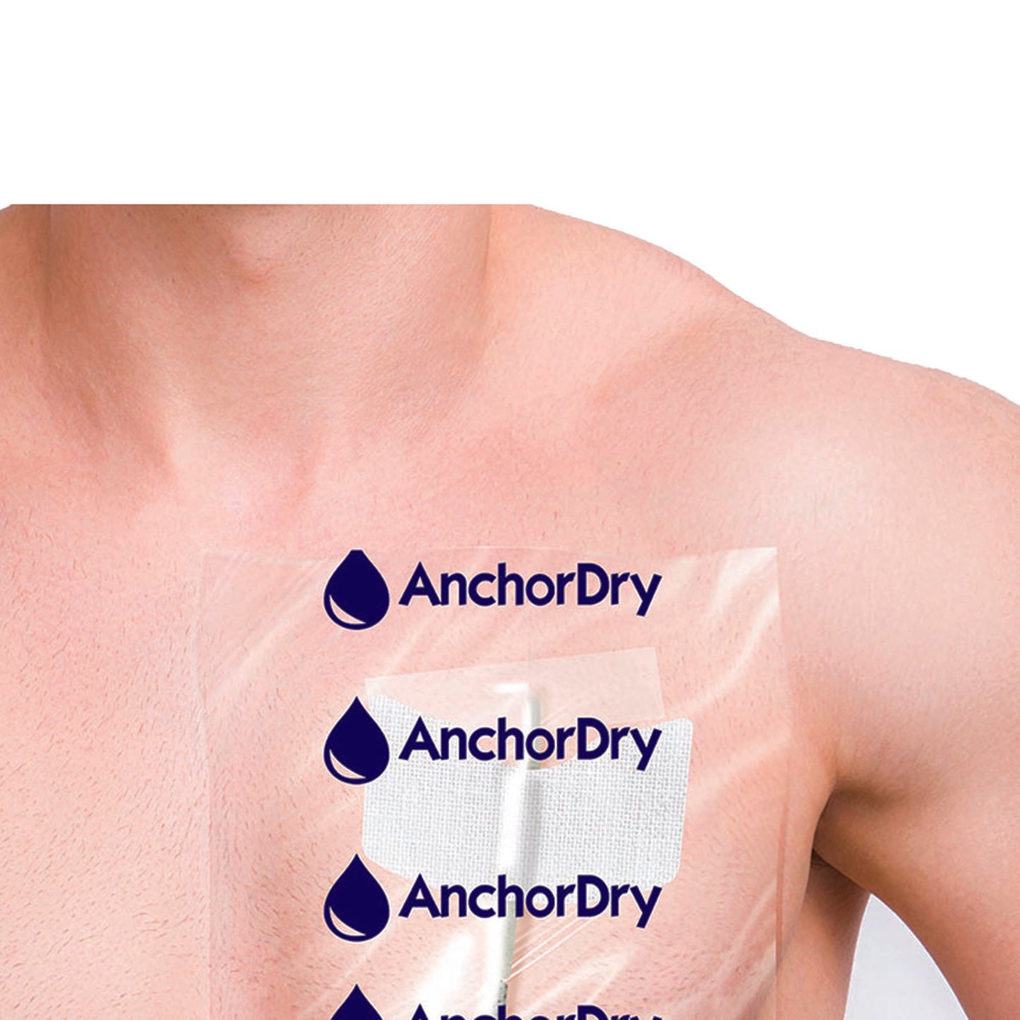 AnchorDry™ IV Site Barrier Protector, 7 x 7 Inch