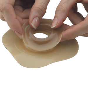 Adapt Convex Barrier Rings 40-mm ID (1-9/16") 10 Count