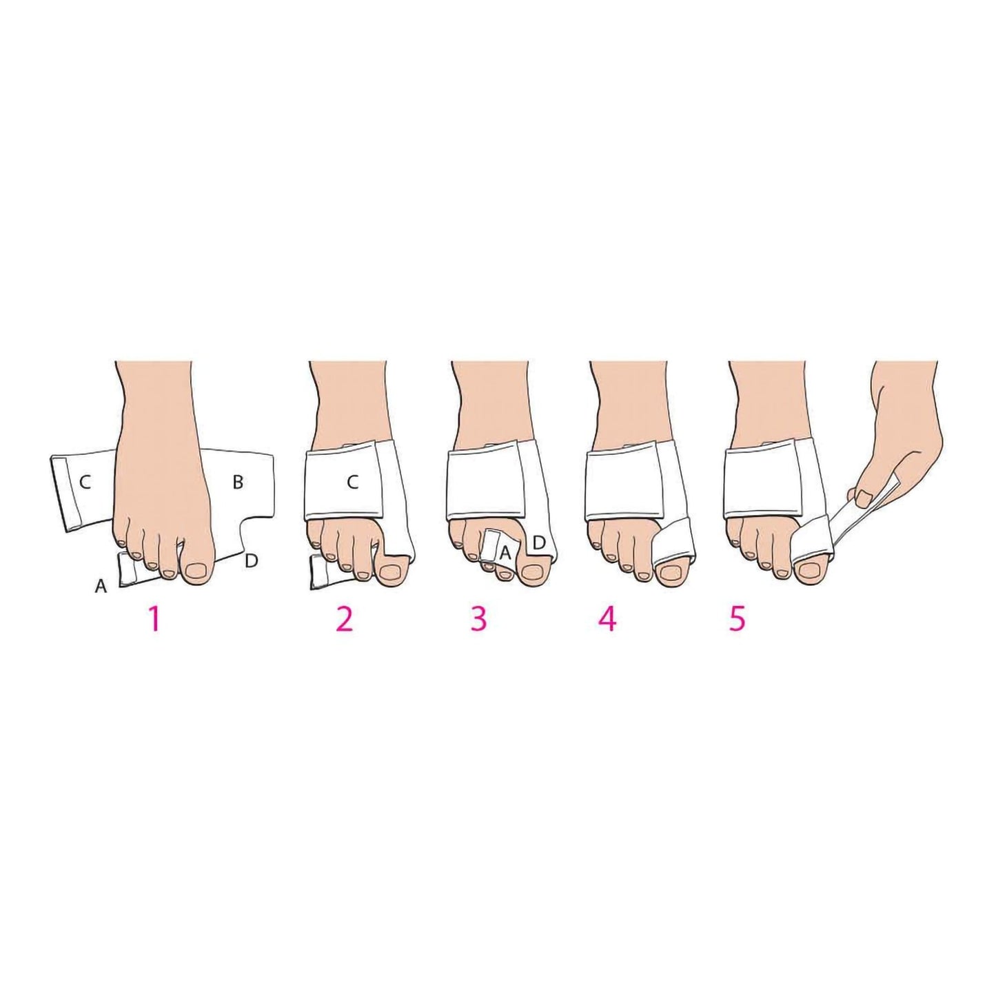 Softsplint™ Bunion Splint for Left Foot, Medium