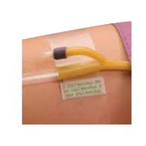Hold-n-Place Foley Catheter Holder Adhesive Patch One Size Fits All