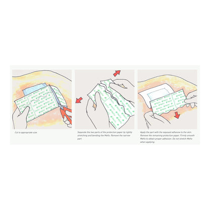 Mefix® Nonwoven Dressing Retention Tape, 4 Inch x 11 Yard
