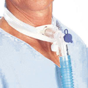 Secure Trach Tube Ties Medium 9"-17"