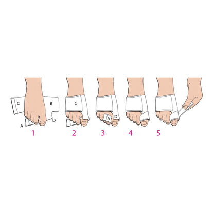 Softsplint™ Bunion Splint for Left Foot, Medium