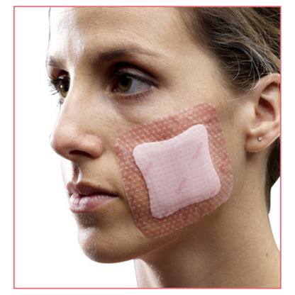 Allevyn™ Gentle Border Lite