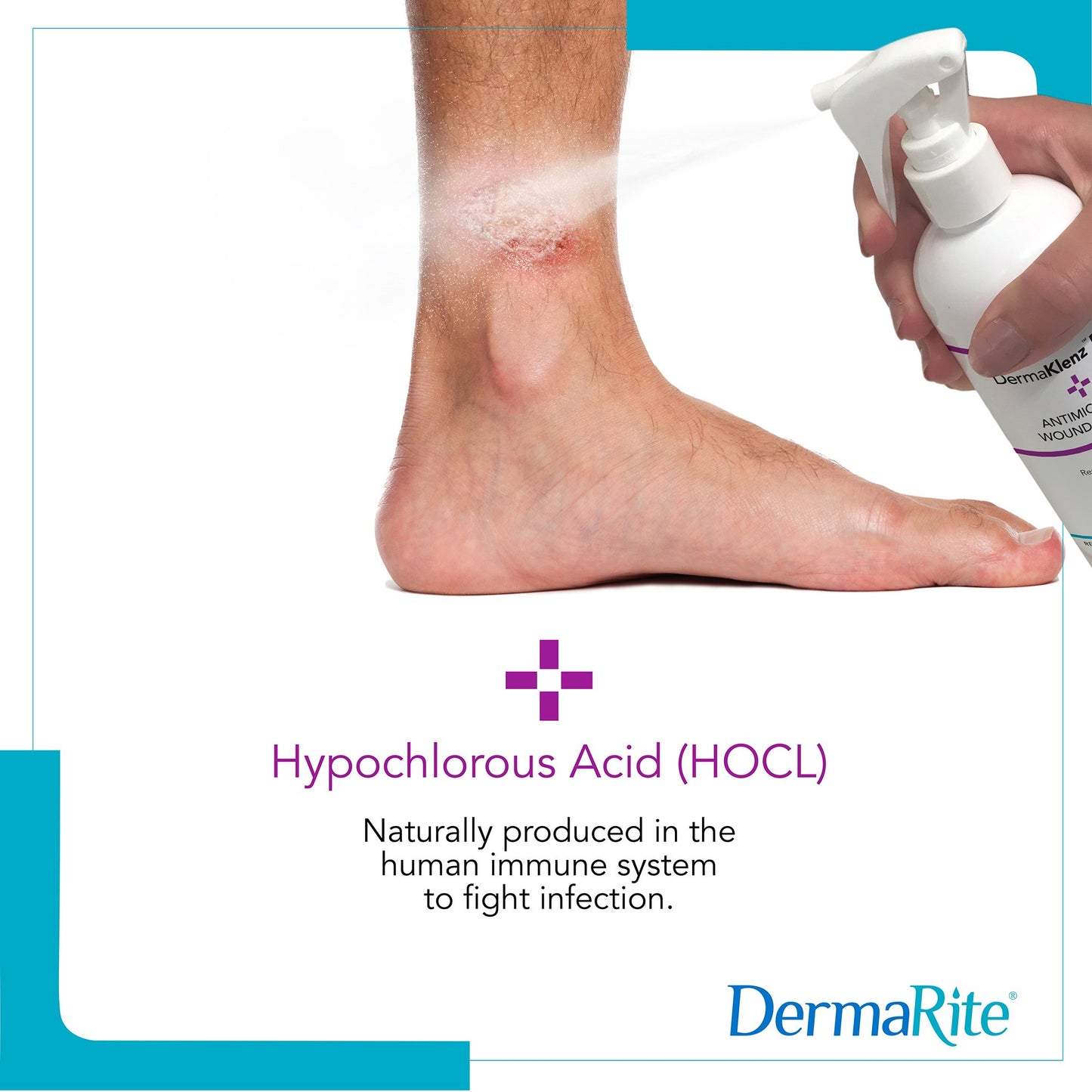 DermaRite®'s DermaKlenz PLUS Wound Cleanser - Spray Bottle, 8 oz.