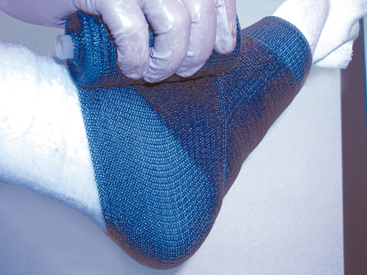 Delta-Lite® Plus Cast Tape, Fiberglass / Resin
