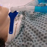 Pediatric Vent Circuit Anti-Disconnect Device