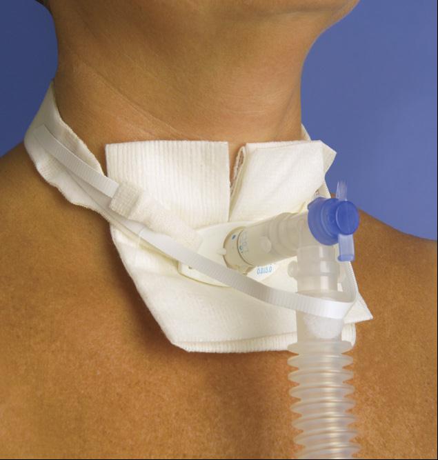 One-Piece Adult Trach-Tie with Ventilator Anti-Disconnect Device