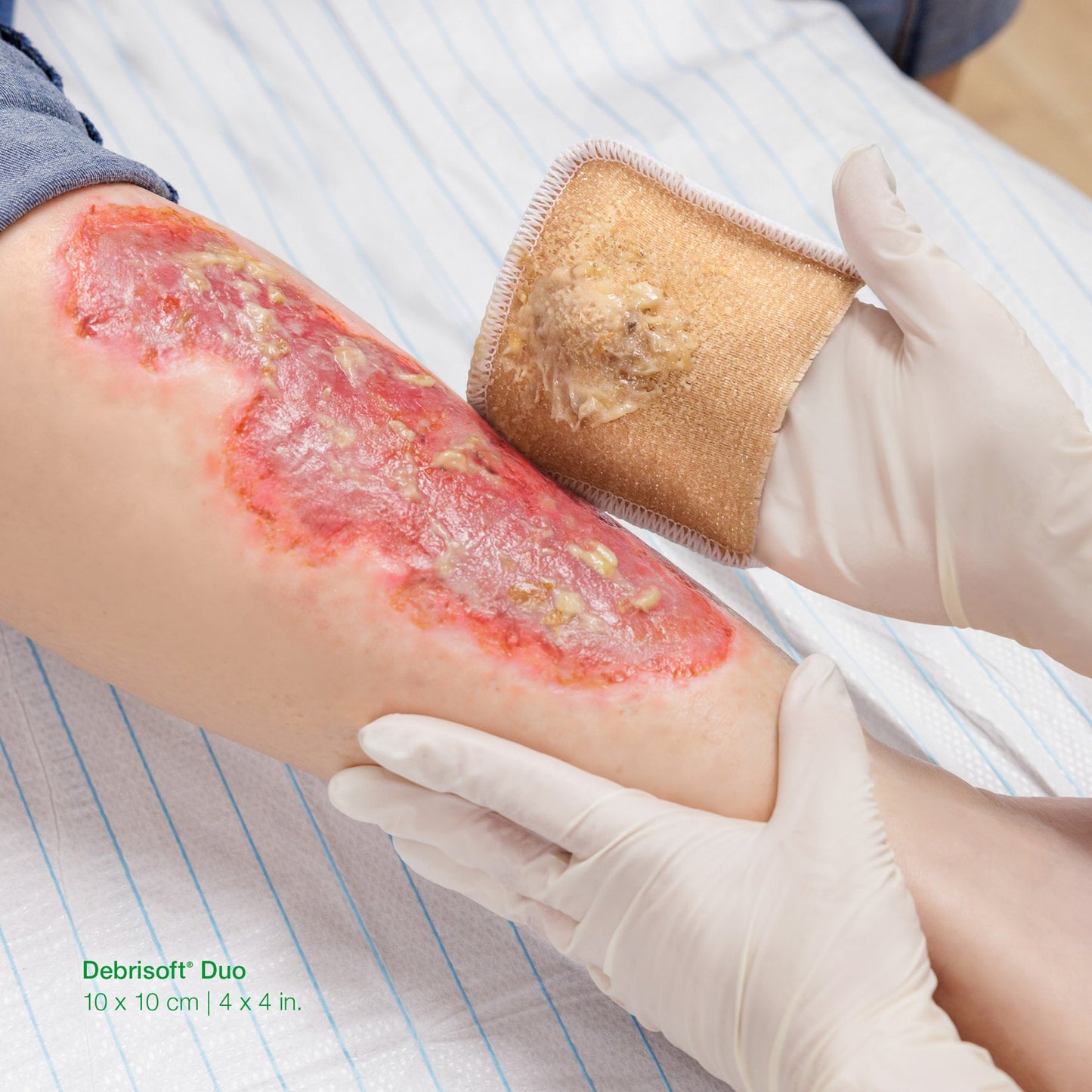Debrisoft® Debridement Agent, 4 x 4 Inch